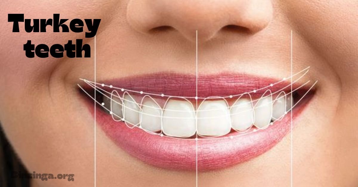 You are currently viewing Turkey Teeth: What You Need to Know Before Your Smile Makeover Adventure